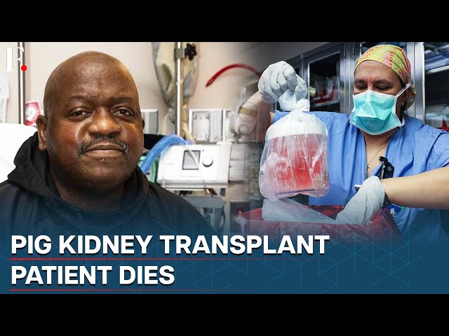 First man to get pig's kidney transplanted died after two months of operation